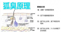 大連林西縣遺傳性狐臭怎么解決
