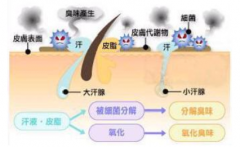 大連療效治療狐臭存在哪些困難